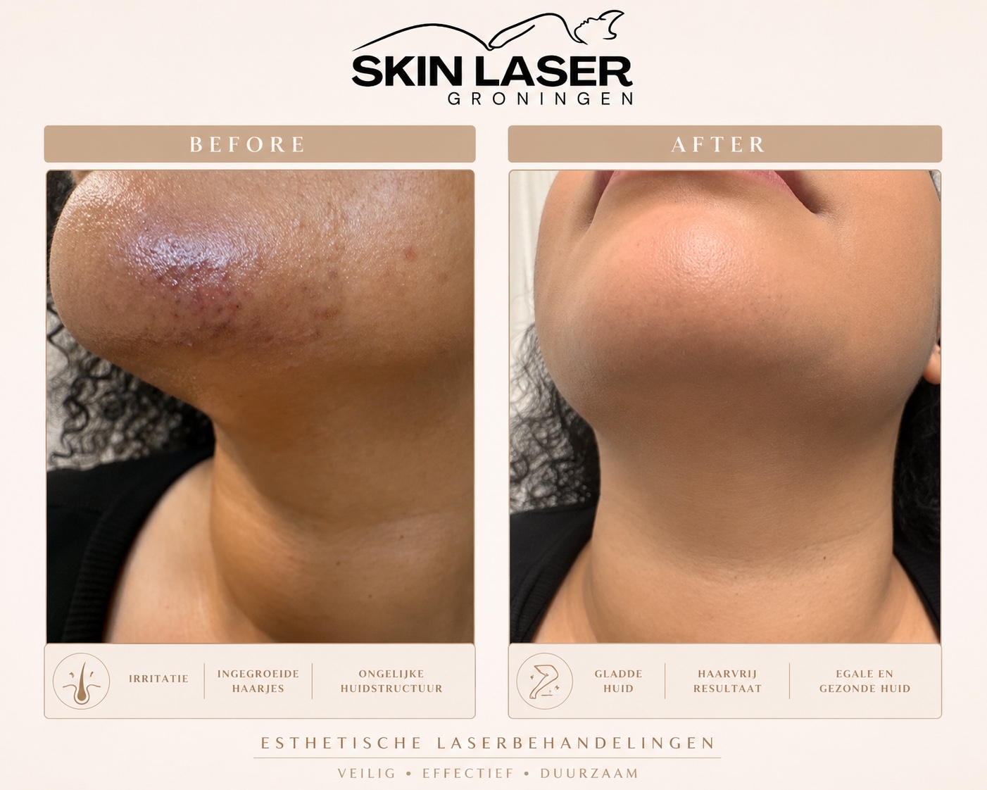 Before en after resultaat